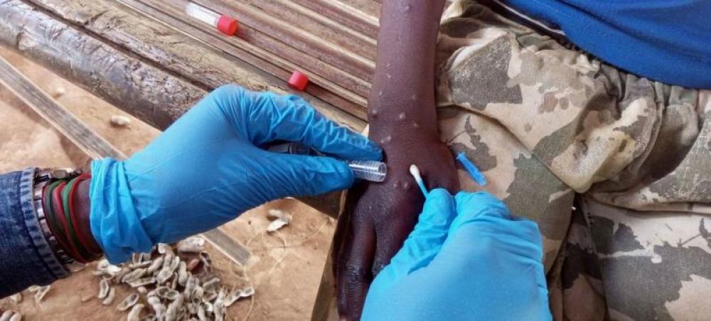 WHO approves first mpox diagnostic test for emergency use