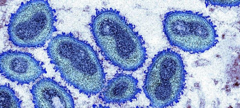 First deadlier strain of mpox detected in Thailand 