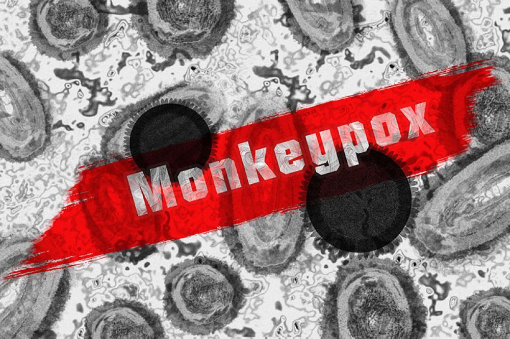 Shocking Case: Scientists accused of smuggling deactivated Mpox virus into America 