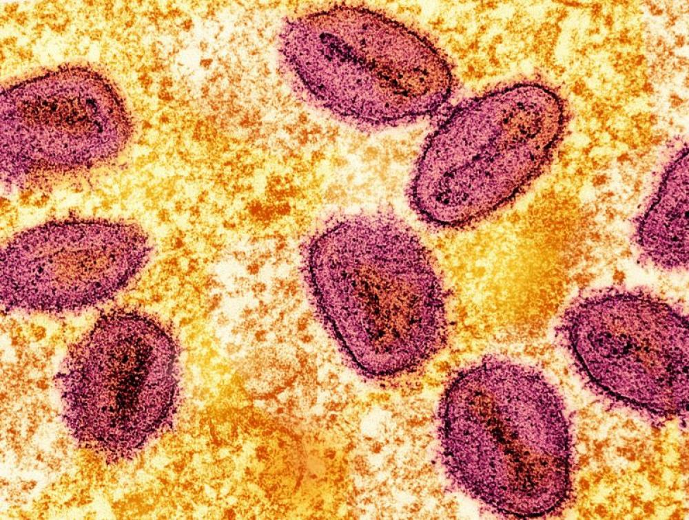 New hybrid Mpox strain surfaces in UK and India &mdash; WHO sounds global alert 