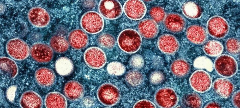 After Sweden, Pakistan reports three cases of deadly Mpox virus, patients came from UAE