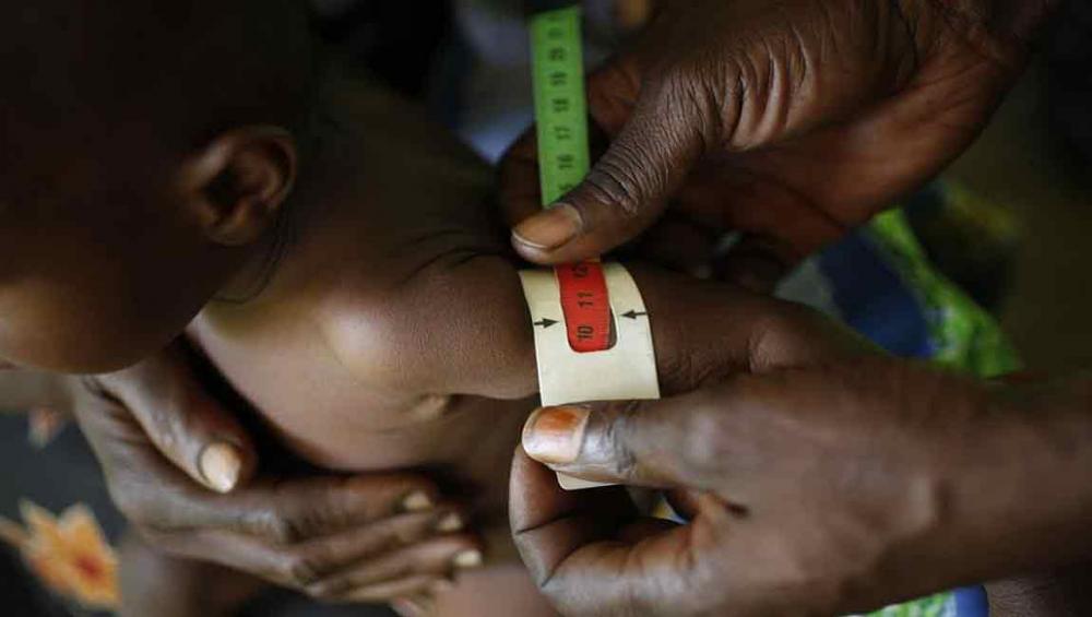 DR Congo’s economy loses over $1 billion to child undernutrition, finds UN-backed study