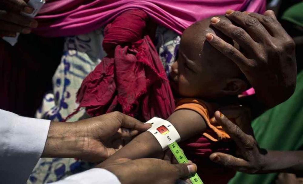 As famine looms, malnutrition and disease rise sharply among Somali children - UNICEF